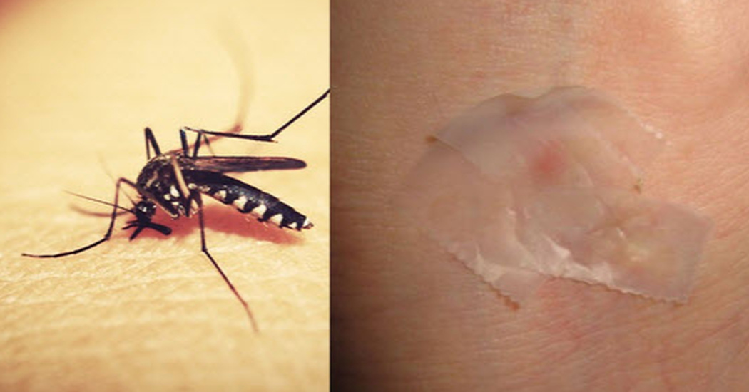 ways to stop mosquito bite itch